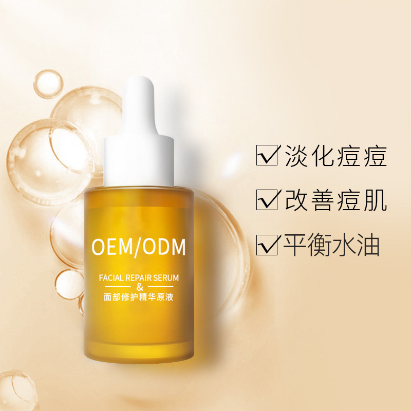 锦州市_祛痘精华原液OEM